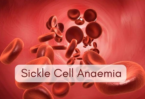India Reaches 6 Crore Screenings under National Sickle Cell Anemia Elimination Mission