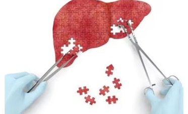 WHO Reclassifies Hepatitis D as Cancerous, Urges Stronger Prevention Measures