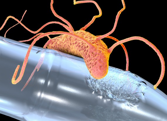 Plastic-Eating Bacterium Ideonella sakaiensis Offers Hope for Tackling PET Pollution