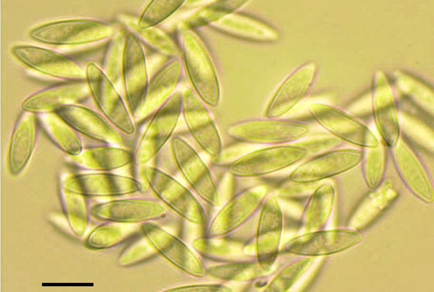 Parasynnemellisia khasiana