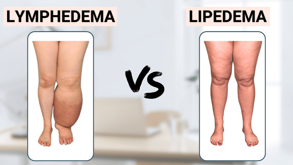 Lymphedema