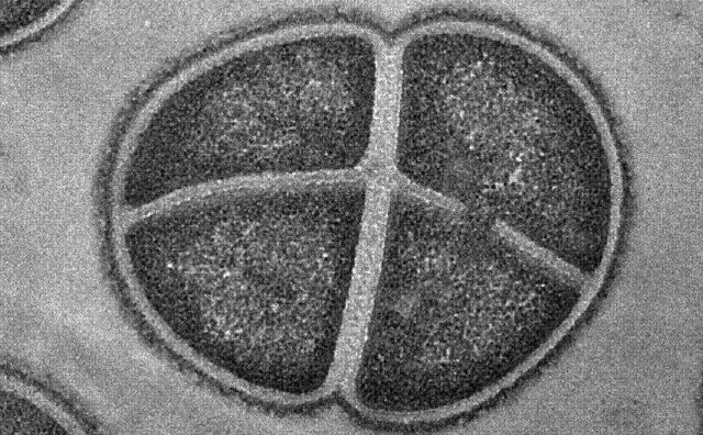Deinococcus radiodurans