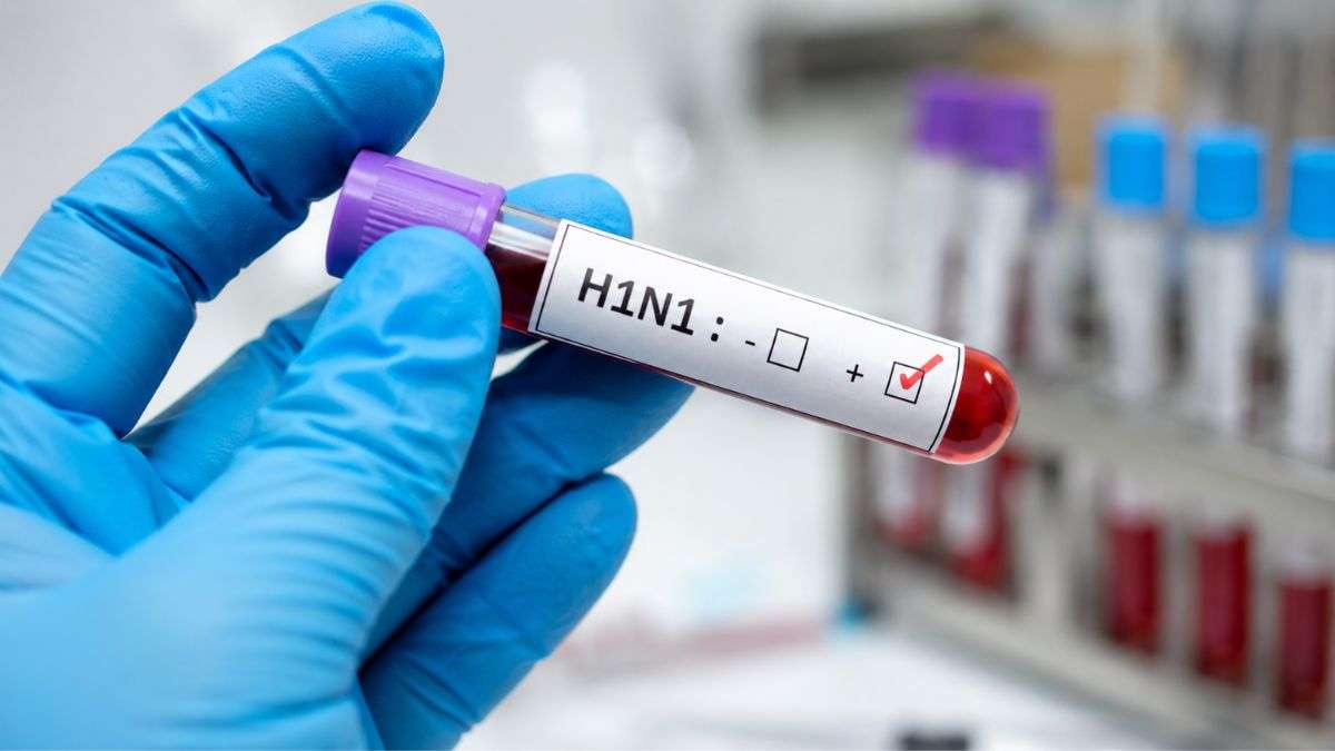 H1N1 Cases Rise Across India Amid Seasonal Respiratory Infections